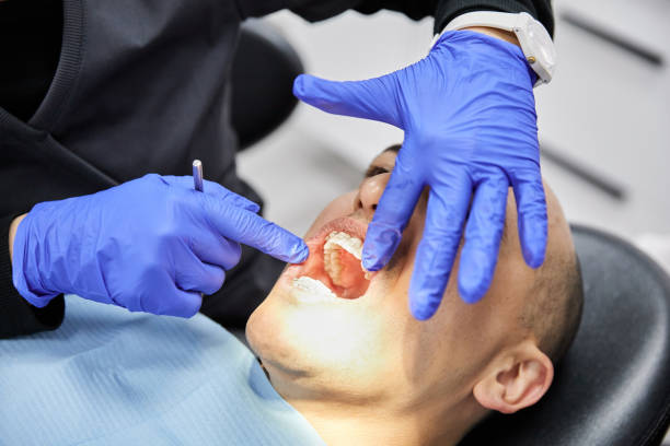 Best Emergency Treatment for Oral Infections in East Syracuse, NY